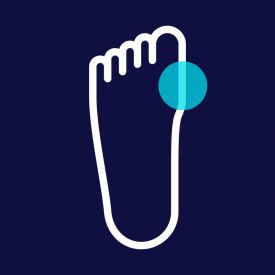 Bunion_FeetBCN_Feet